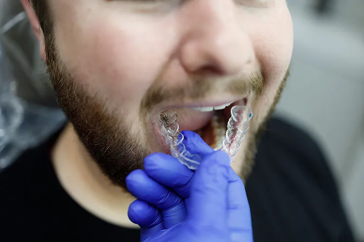 Patient getting invisalign aligners removed - Harmony Family Dentistry in Vancouver WA