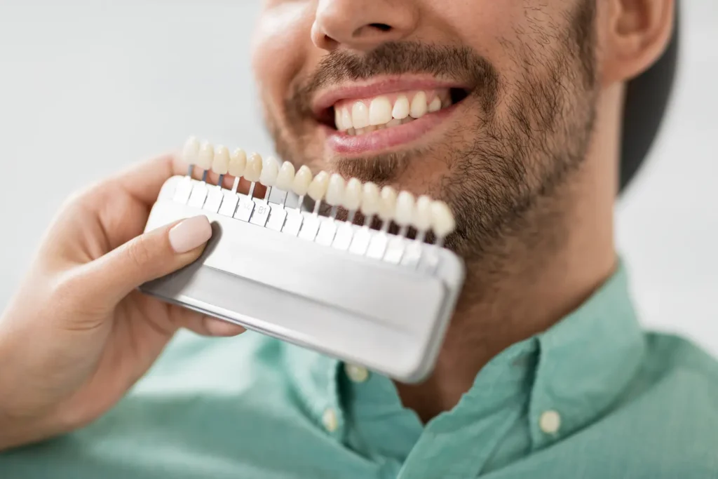 Dental patient reviews tooth shades while trying to decide how bioclear compares to porcelain veneers
