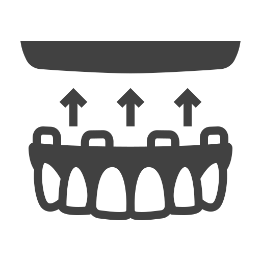 all-on-x dental implants