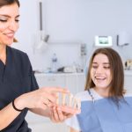 Minimal Prep Veneers in Vancouver