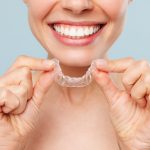 why choose Invisalign treatment