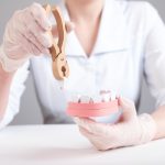 reasons for tooth extraction