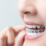 invisalign for severe crowding